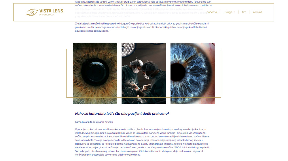 Vista Lens Galerija